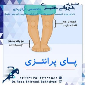 زانو پرانتزی