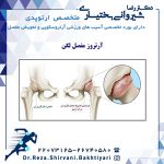 آرتروز مفصل لگن