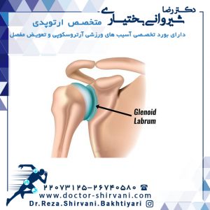 آیا بازسازی لابروم شانه ممکن است؟؟