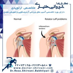 عکس روتاتور کاف شانه