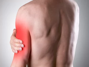 پارگی تاندون عضله سه سر بازو