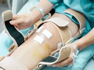 مراقبت های بعد از عمل منیسک زانو