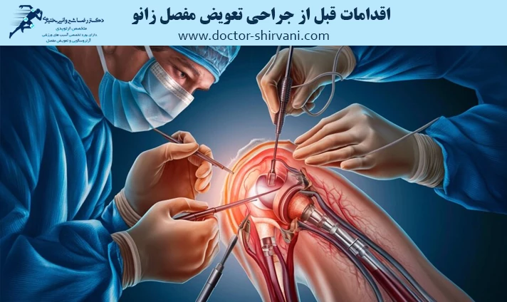 اقدامات قبل از جراحی تعویض مفصل زانو