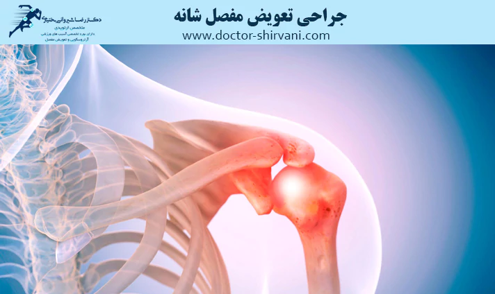 جراحی تعویض مفصل شانه