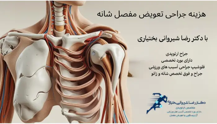 هزینه جراحی تعویض مفصل شانه با دکتر رضا شیروانی